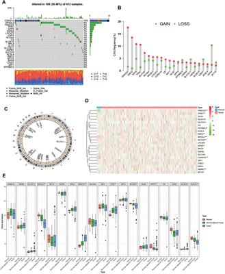 Ferroptosis Patterns and Tumor Microenvironment Infiltration Characterization in Bladder Cancer